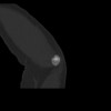 SPORK, NICO - 22.03.1976 - 02.08.2022 - CT obere Extremität - 18:01:46